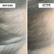 Medicated Hair Loss Advanced Solution